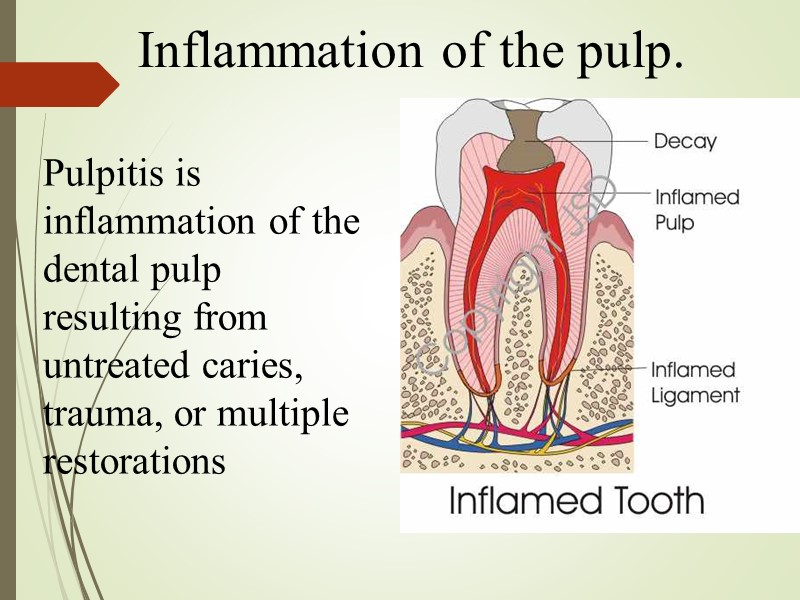 Inflammation of the pulp.  Pulpitis is inflammation of the dental pulp resulting from